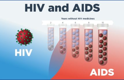 HIV (AIDS) Nasıl Anlaşılır, Belirtileri Nelerdir?
