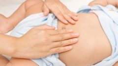 Bebeklerde Göbek Fıtığının Sebepleri Nelerdir?